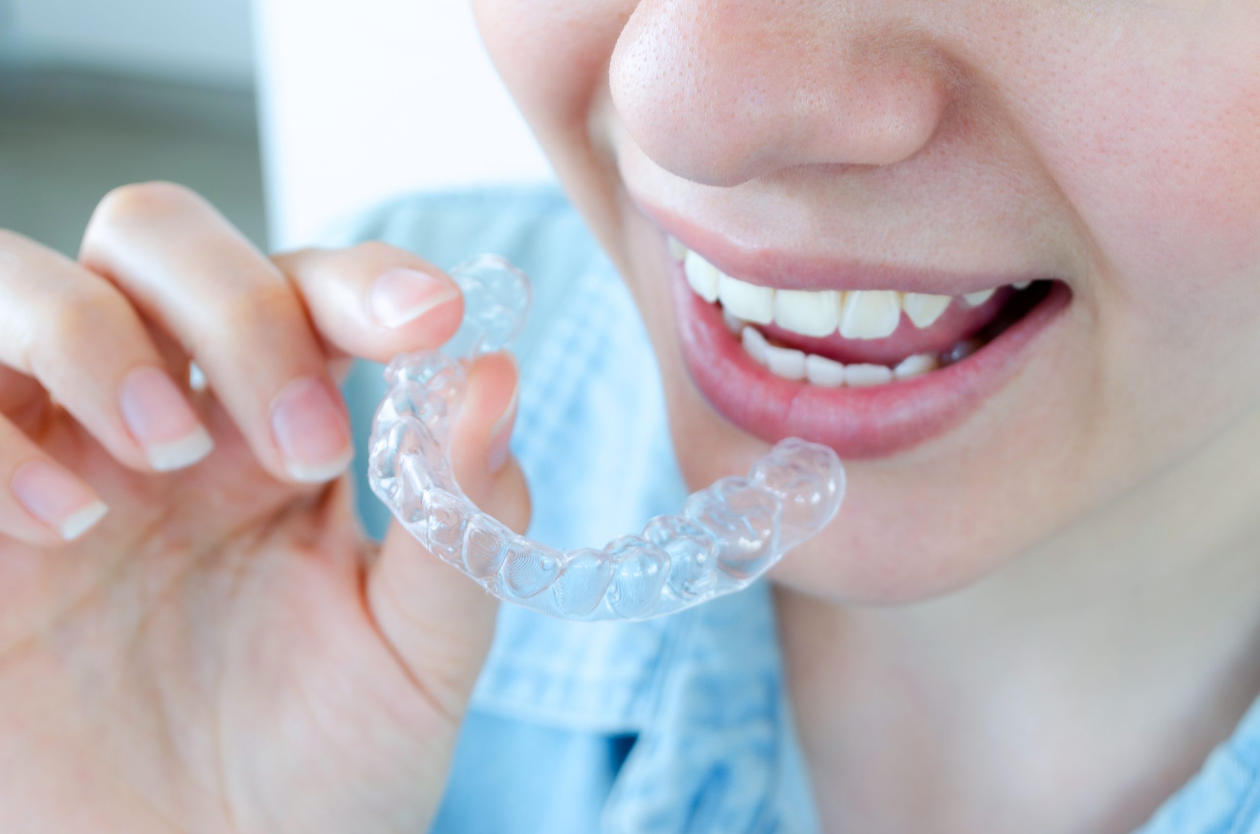 Invisalign